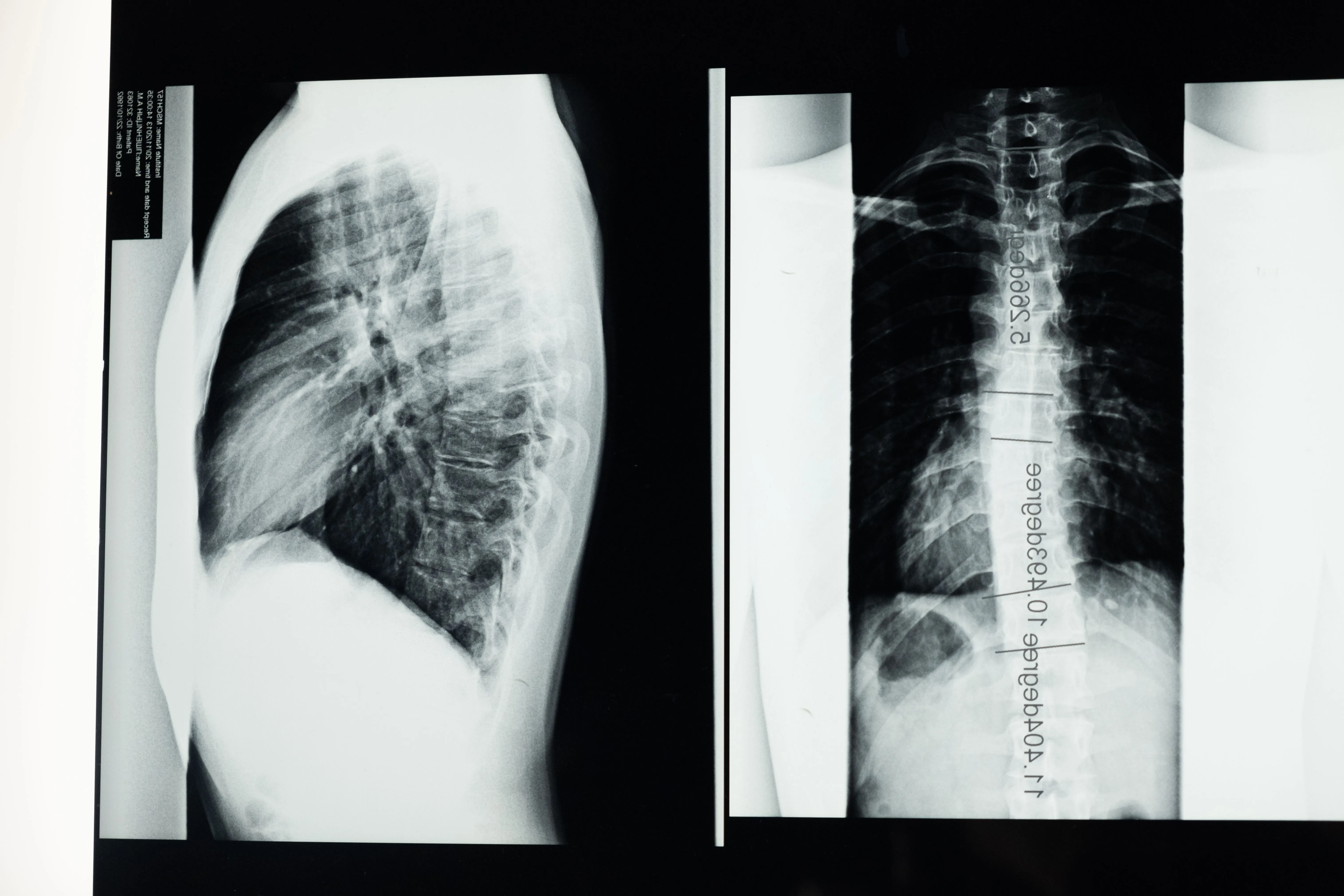 An x-ray