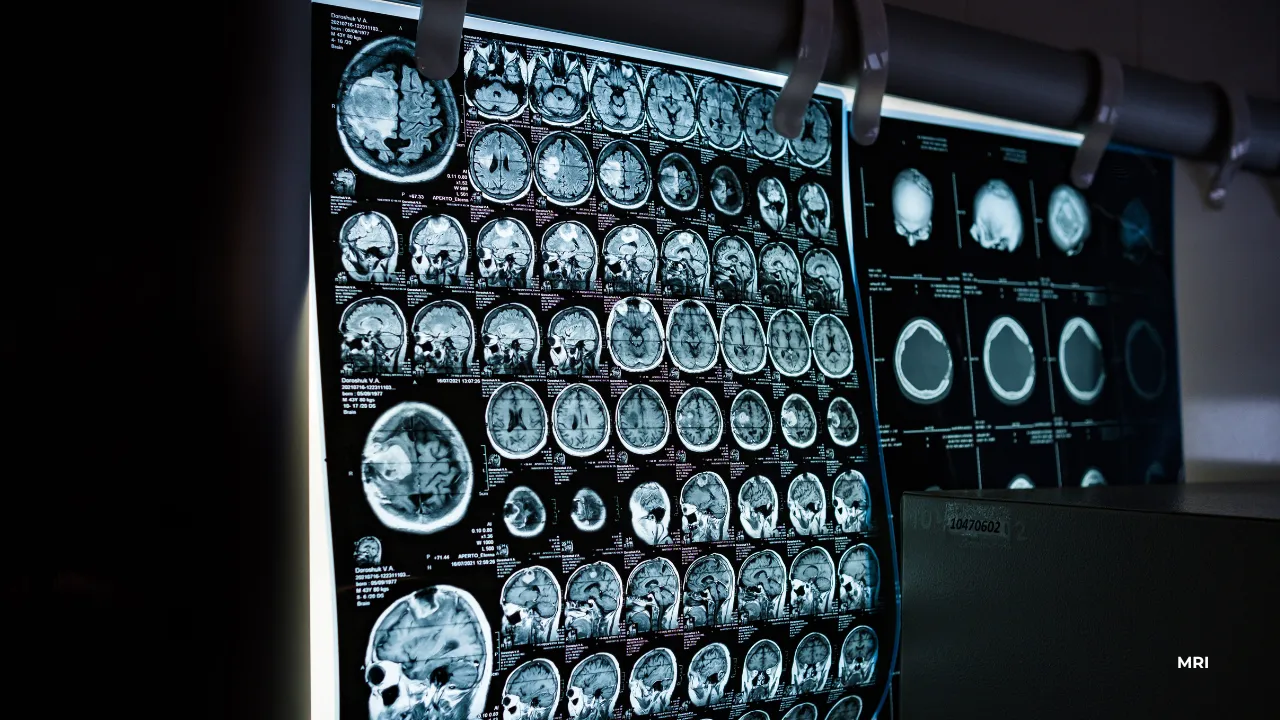 MRI scans of a brain