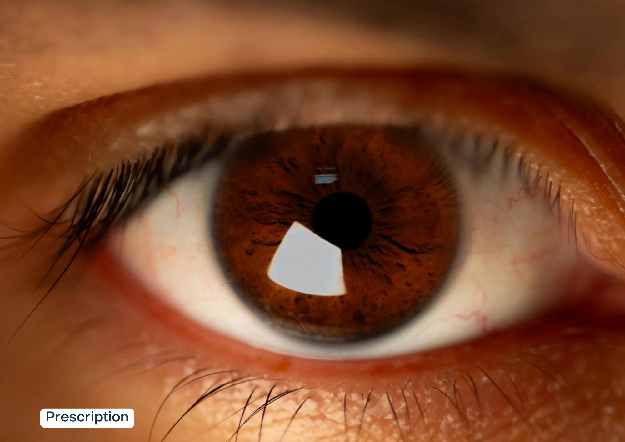 A brown eye