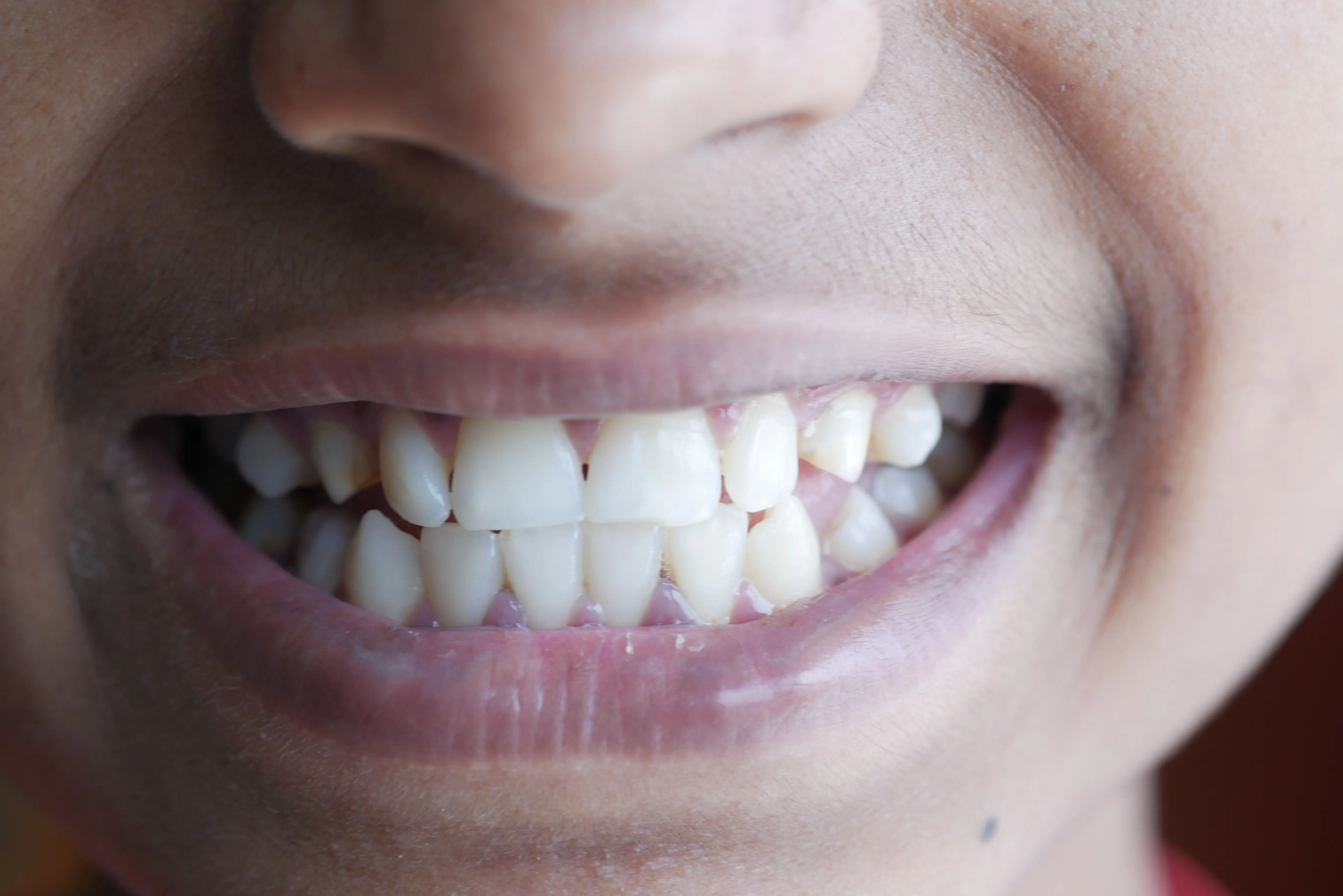 A smile of a person with clean teeth.